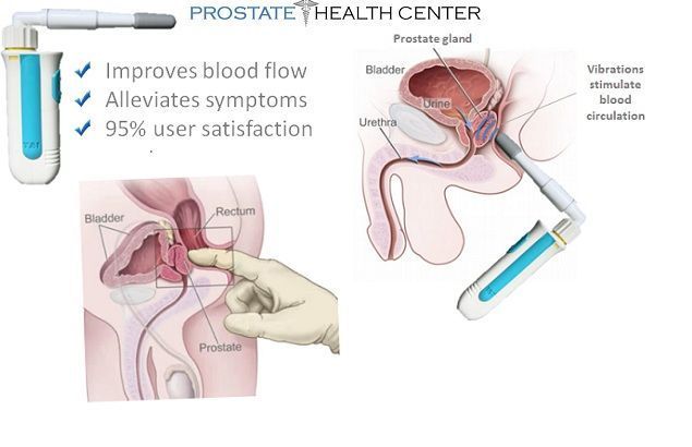 best of Techniques prostate masturbation stimulation anus