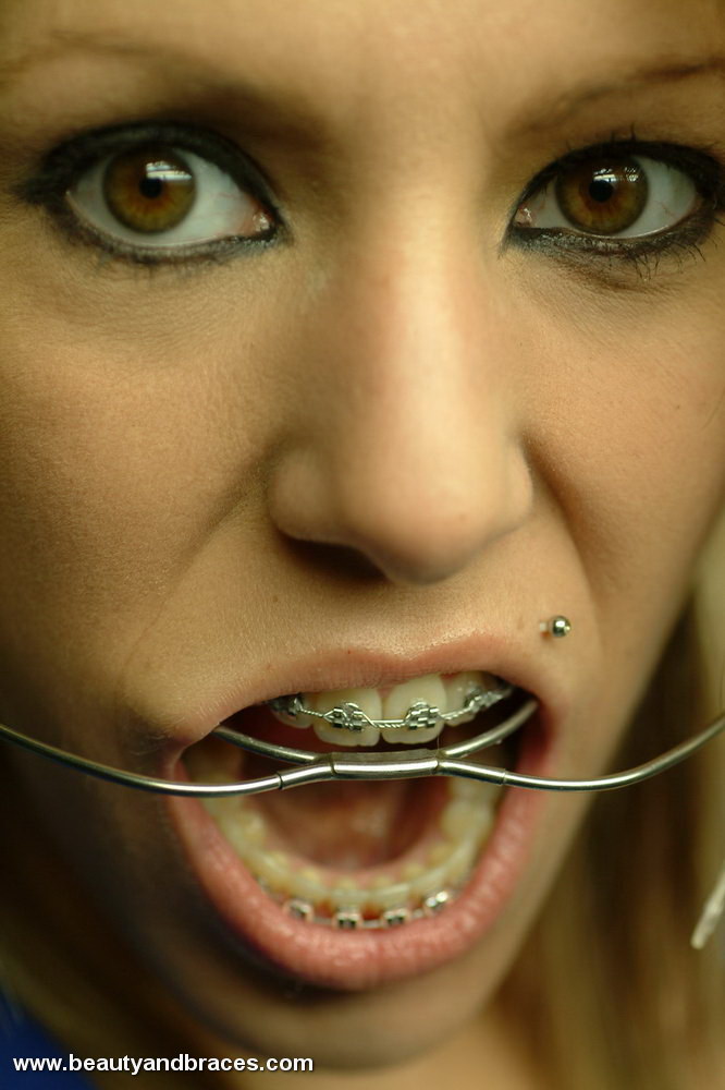 Fiend reccomend fetish woman wearing braces